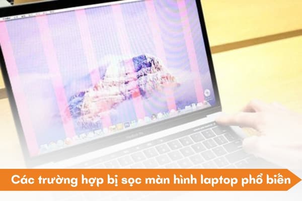 Bị Sọc Màn Hình Laptop: Nguyên Nhân Và Cách Sửa Hiệu Quả (Mới Nhất)
